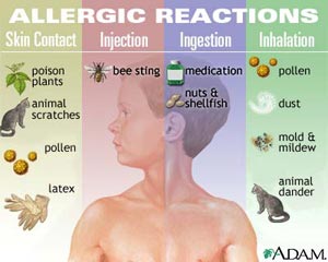 Allergnes